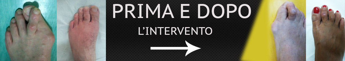 Prima e dopo l'intervento