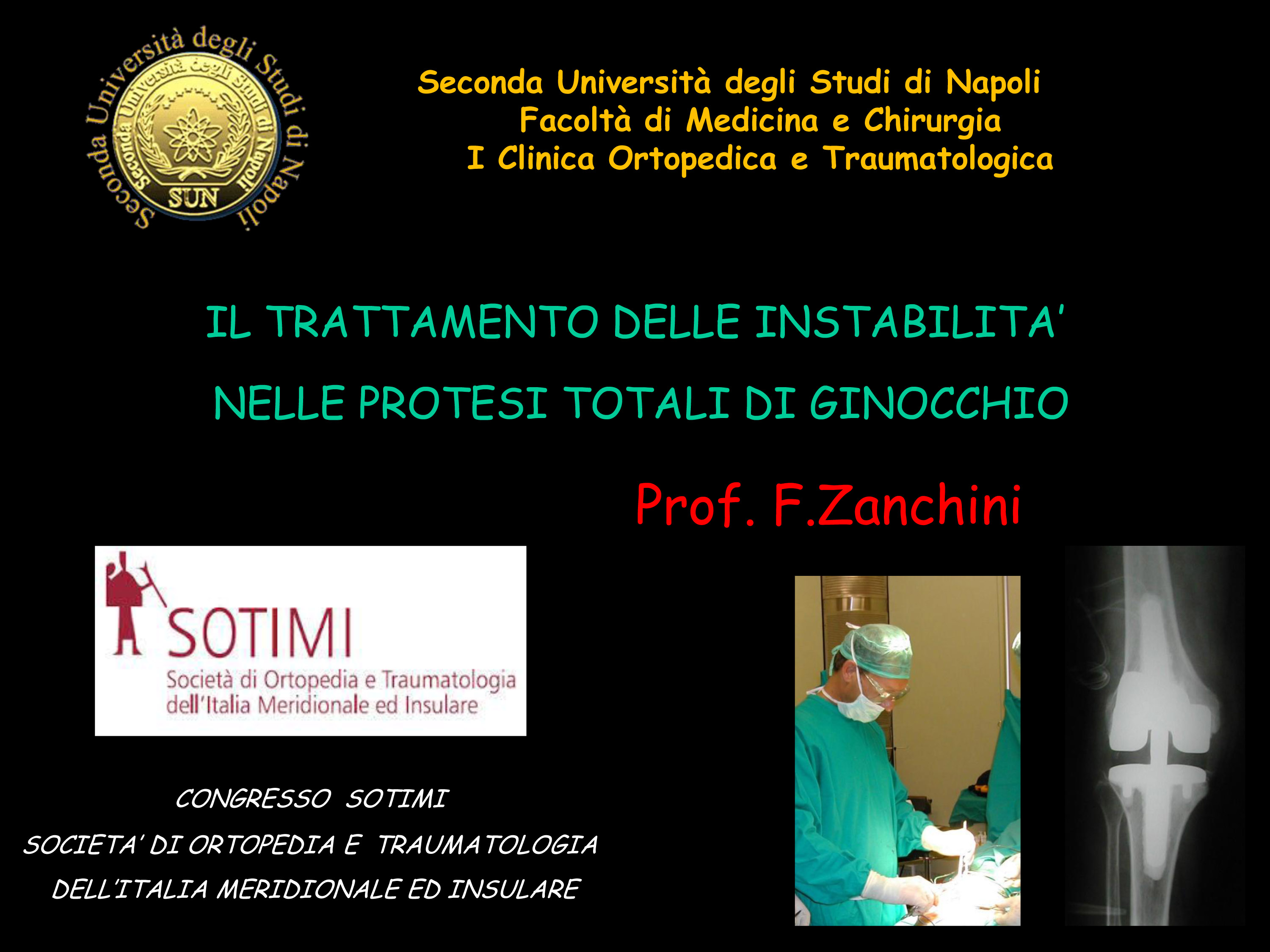 INSTABILITA NELLE PTG