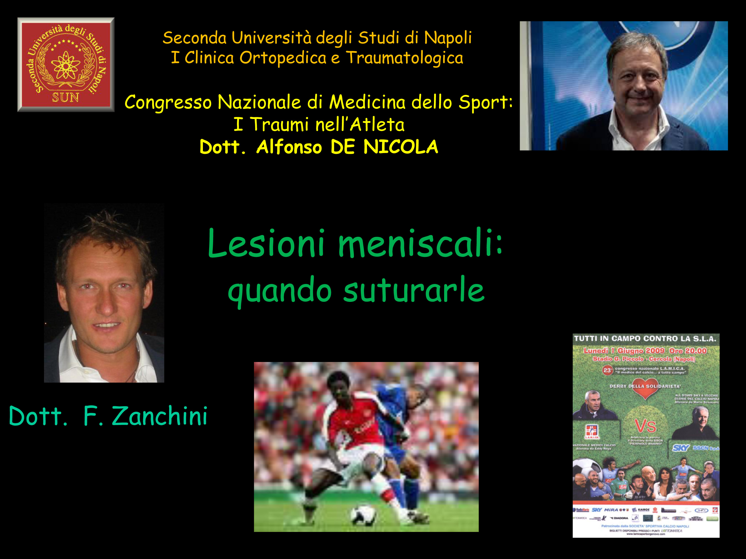 Le lesioni meniscali quando suturarle