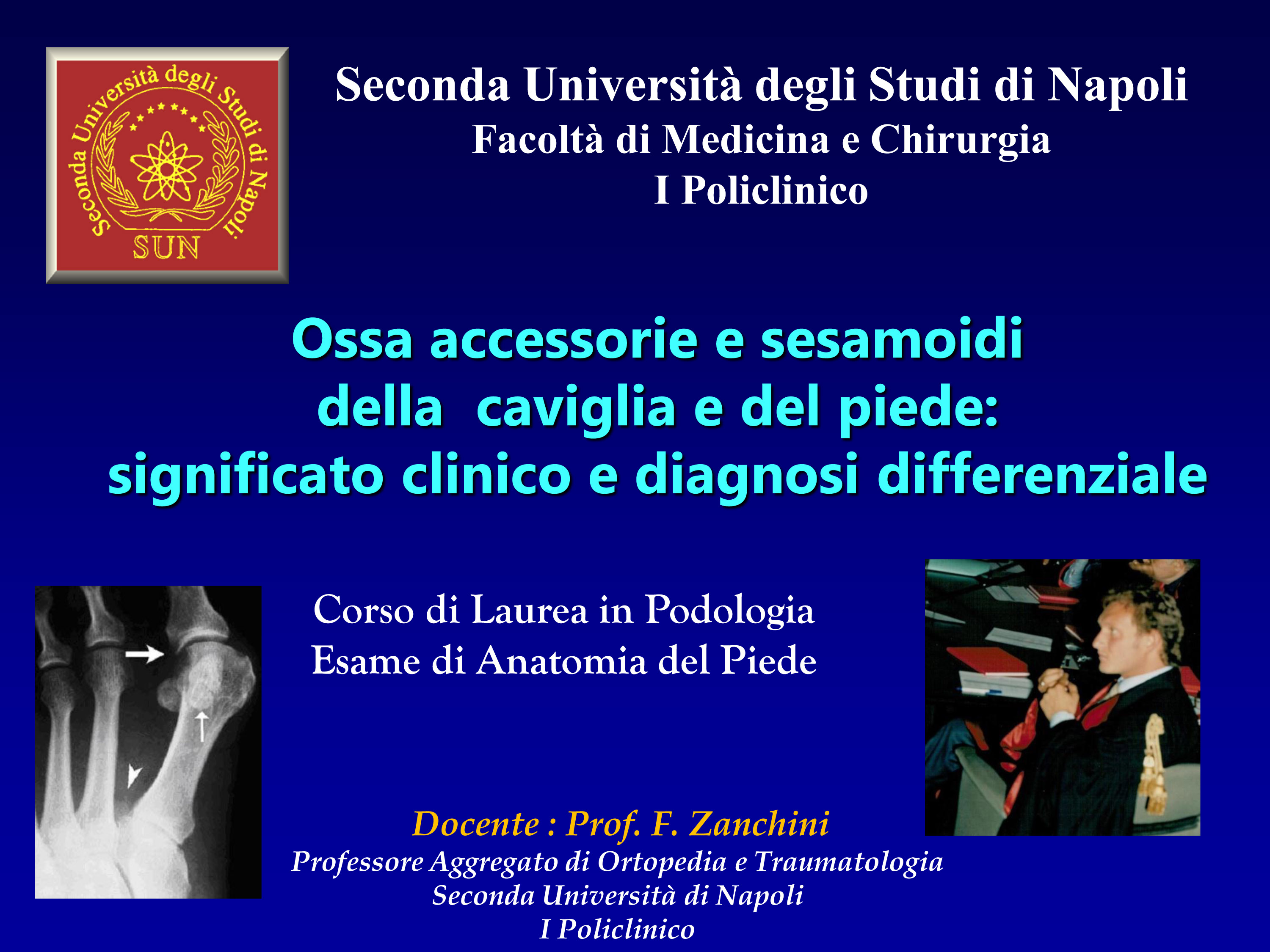 Ossa accessorie della caviglia e del piede