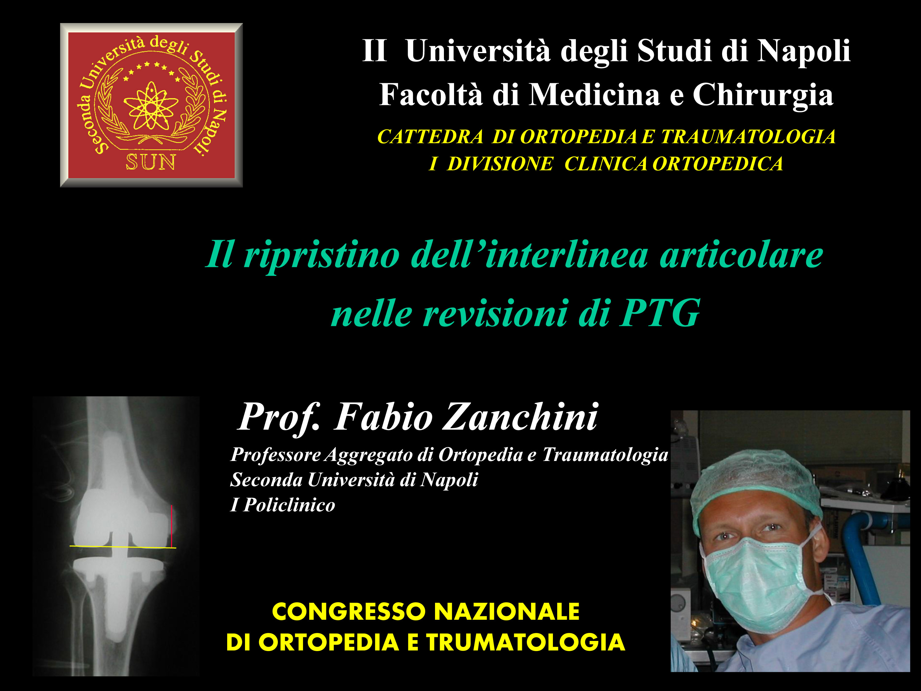 interlinea articolare nelle revisioni PTG
