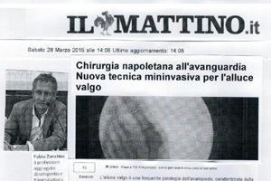 Alluce valgo, la chirurgia è 