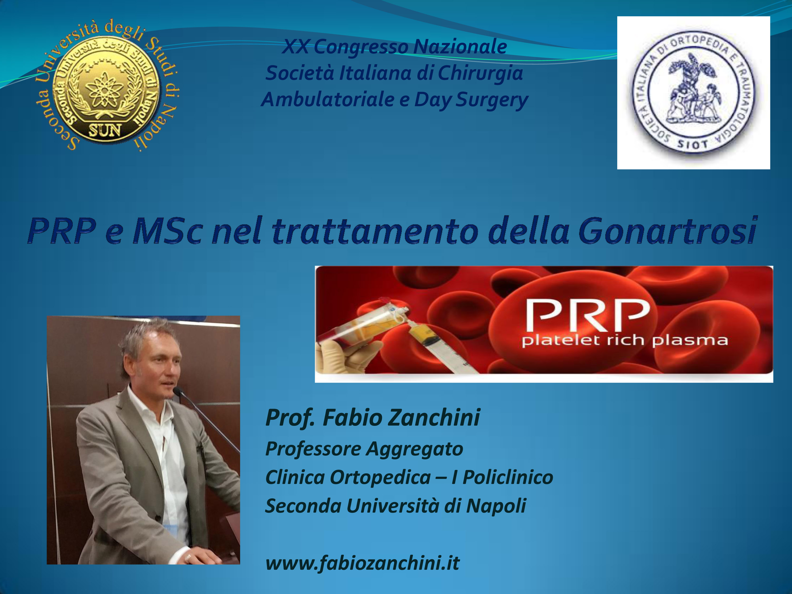 PRP e MSc nel trattamento della Gonartrosi